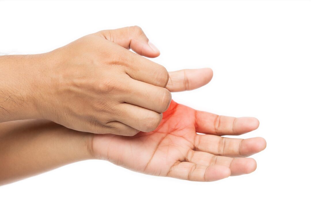 Svrbež s gljivicama i liječenje demyxil kremom